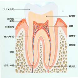 虫歯・う蝕